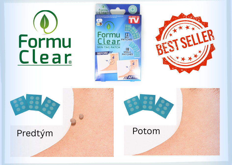 Formu-Clear-naplasti-na-odstranovanie-koznych-vyrastkov