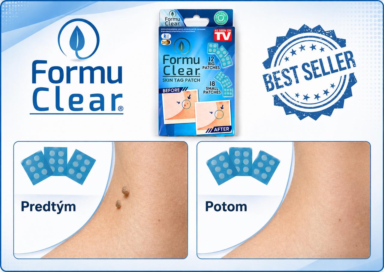 Formu-Clear-naplasti-na-odstranovanie-koznych-vyrastkov